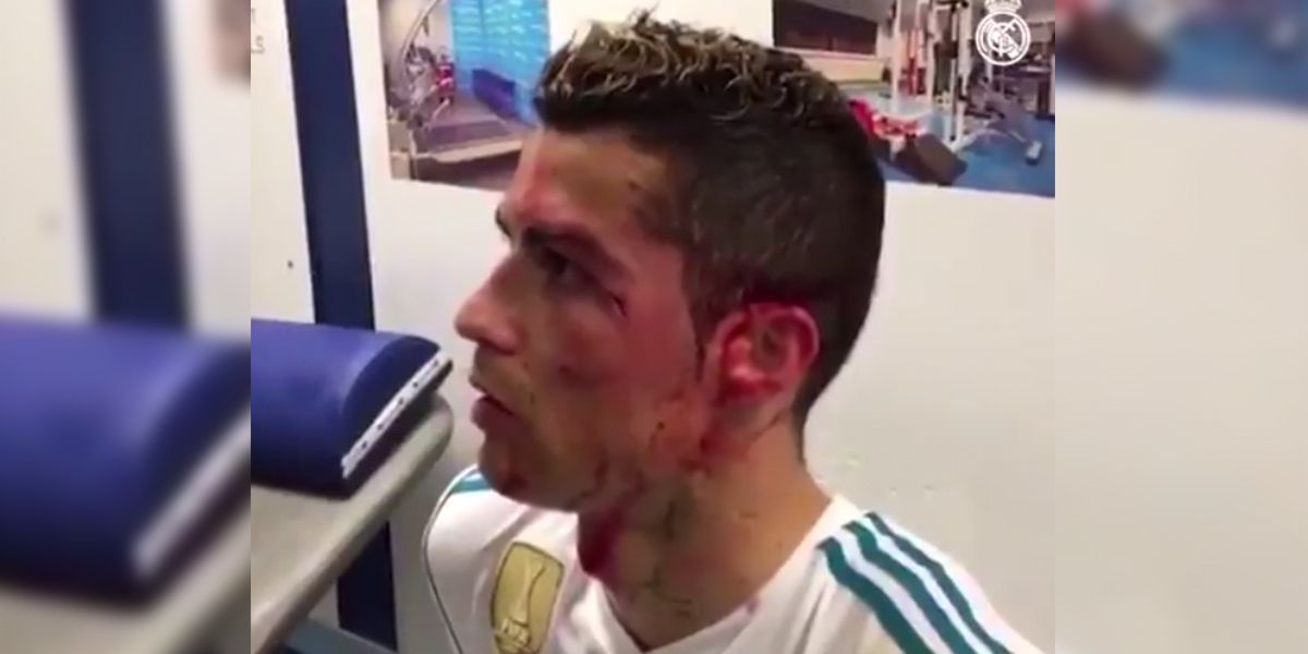 Lo que no se vio de la herida de Cristiano Ronaldo ante el Deportivo La Coruña