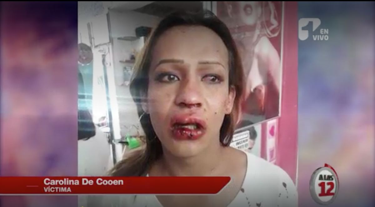 Las hipótesis del brutal ataque a mujeres trasngénero en salón de belleza de Bogotá