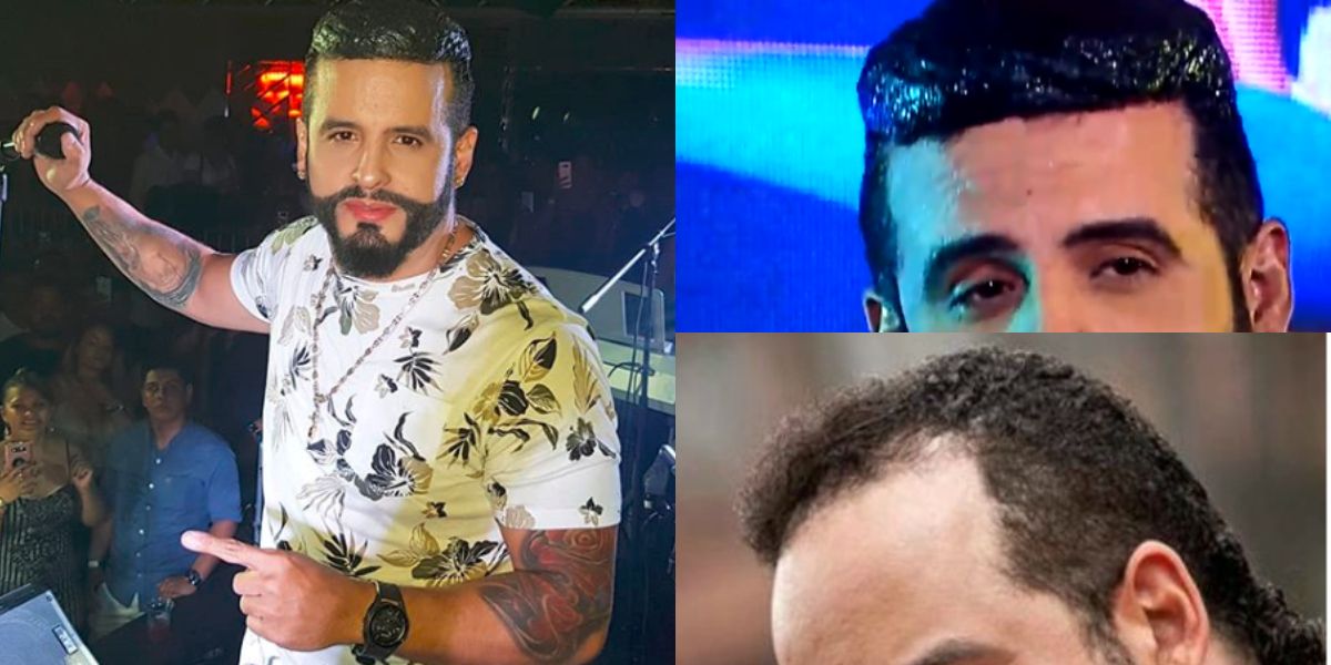 El impactante cabello del cantante Nelson Velásquez que causa burlas en redes sociales