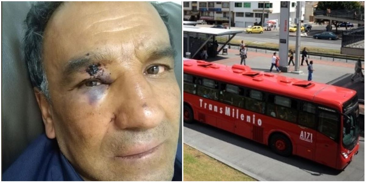 Aseador fue brutalmente golpeado por un “vendedor extranjero” en TransMilenio