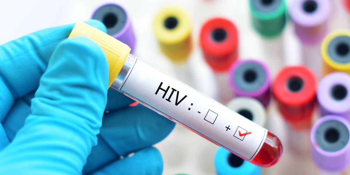 Científicos descubren lo que podría ser la solución para la erradicación del VIH