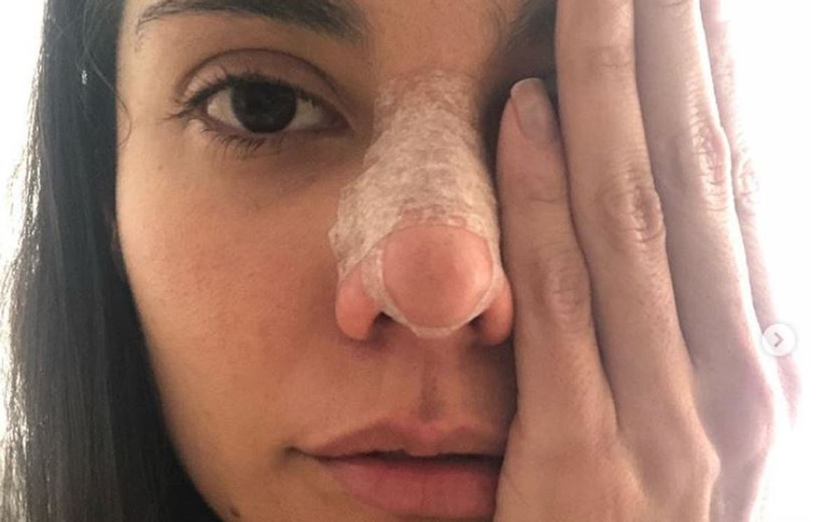 Eileen Moreno publica su primera foto luego de “recuperar” su rostro