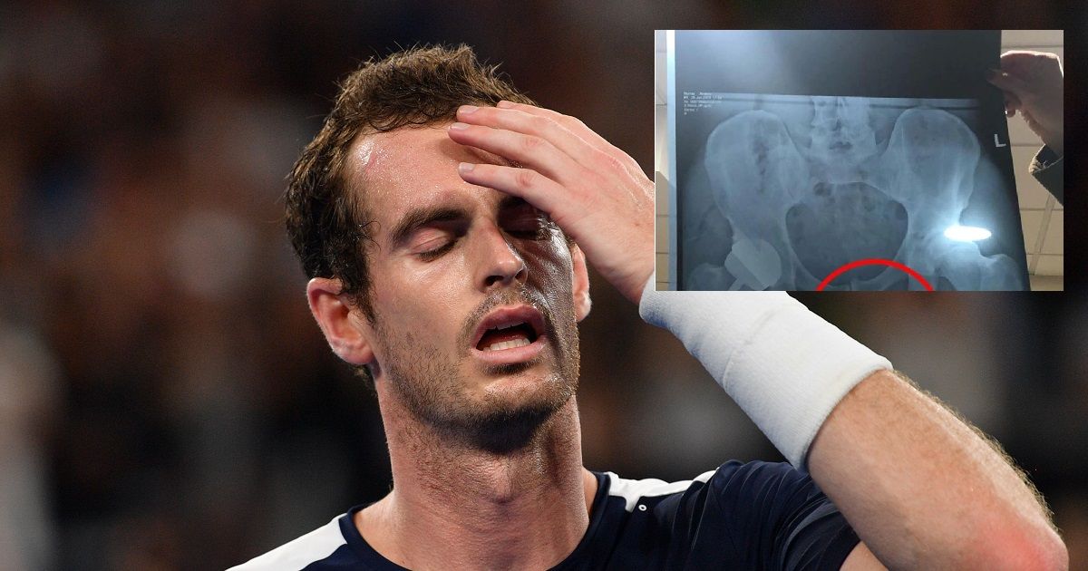 Andy Murray publica radiografía de su cadera sin darse cuenta que aparecía su miembro