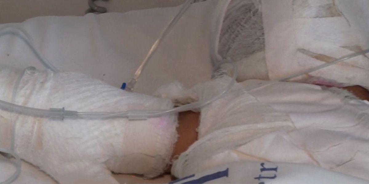 Bebé sufre graves quemaduras con agua hirviendo tras discusión de sus padres en Antioquia