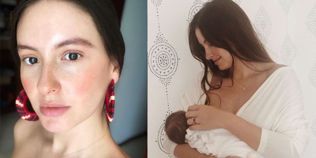 El truco de Taliana Vargas con leche materna para evitar el acné
