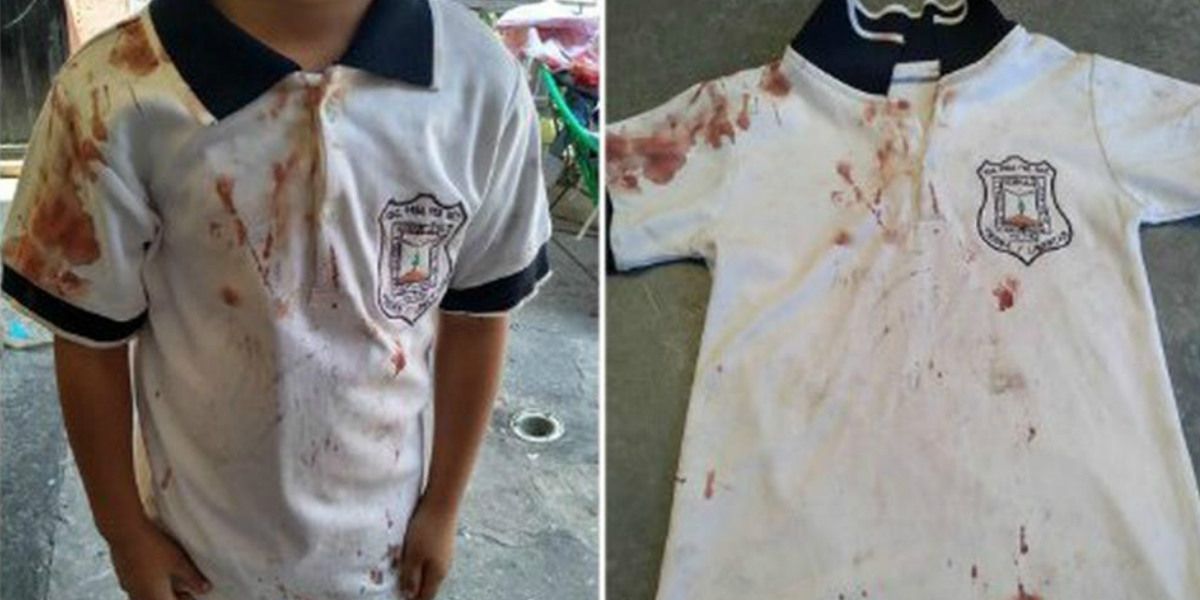 La golpiza a un niño fue tan dura, que mamá denuncia el bullying de su hijo con su camiseta ensangrentada