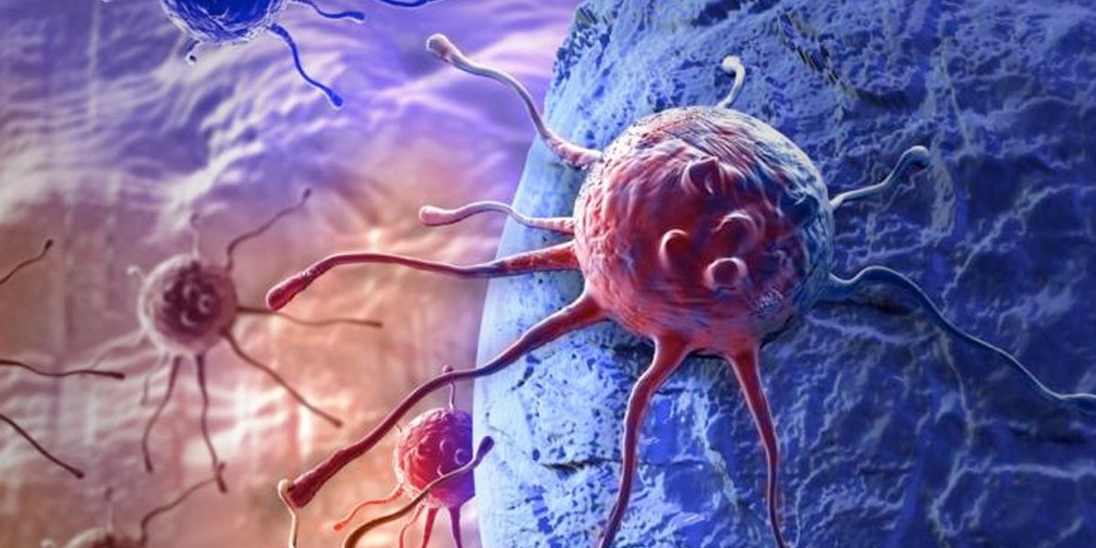 Análisis matemático de imágenes tumorales ayudaría a prever agresividad del cáncer