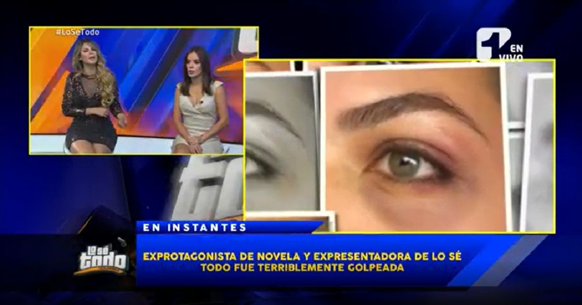 (Video) Expresentadora de Lo Sé Todo denuncia brutal golpiza de su novio