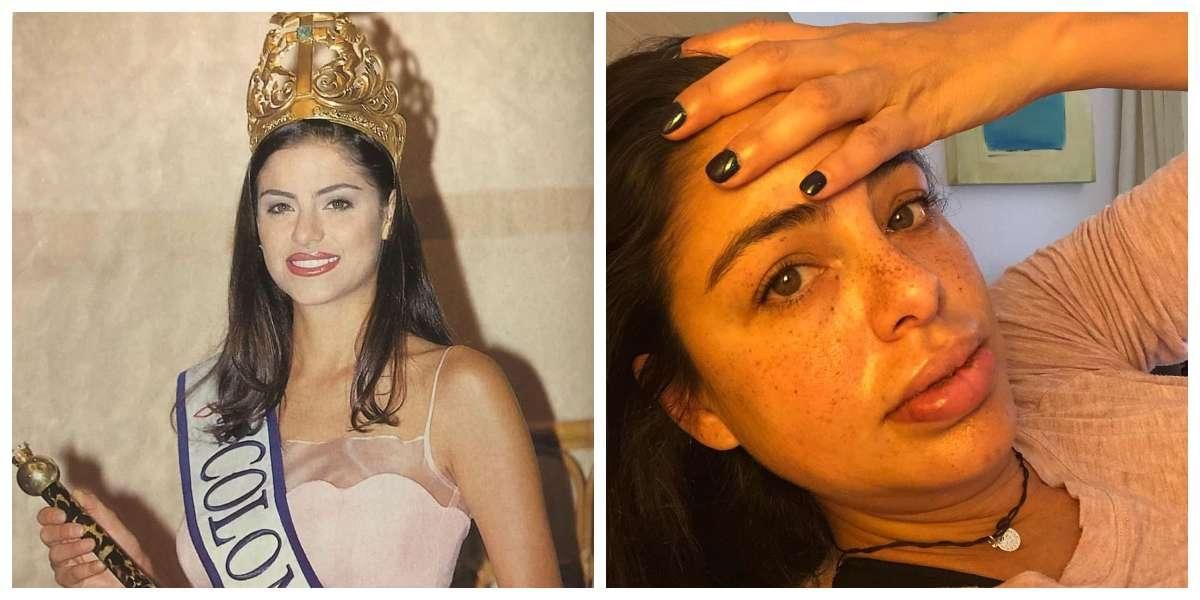 Catalina Acosta muestra el daño en sus labios por inyectarse biopolímeros cuando era reina de belleza
