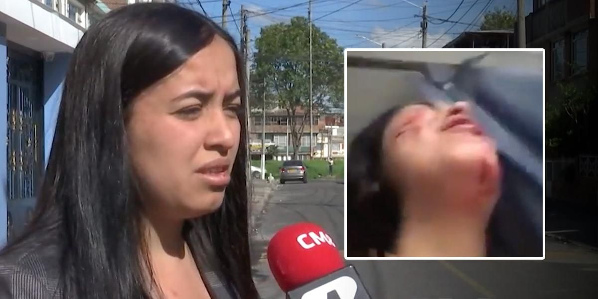 Mujer recibió una brutal golpiza por parte de su expareja en Bogotá