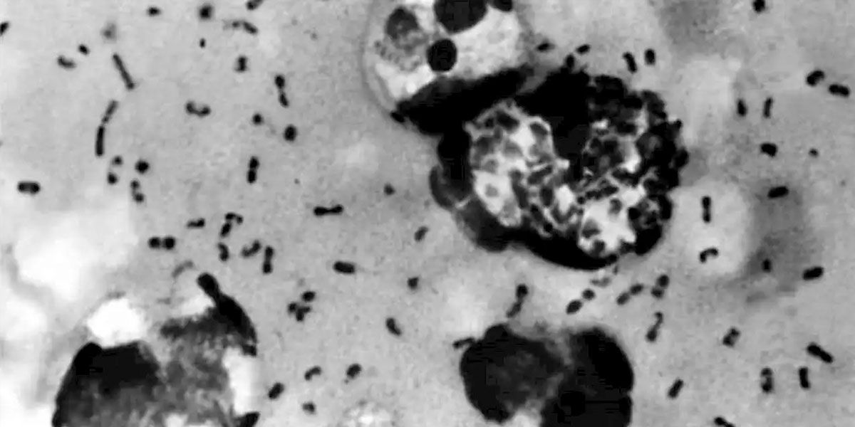 Región de China declara alerta preventiva por un caso de peste bubónica