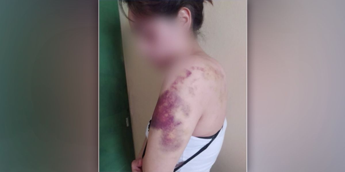Mujer brutal golpiza expareja sentimental Bogotá