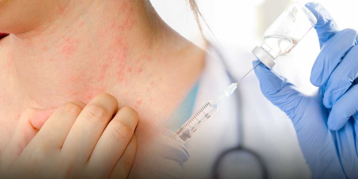 Las alergias y efectos adversos de vacuna contra COVID-19: qué es cierto y qué no