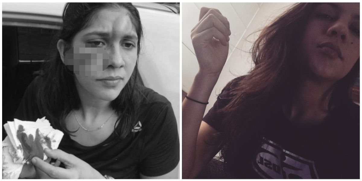 Diana Carreño, joven de 27 años, denunció que fue víctima de una brutal agresión