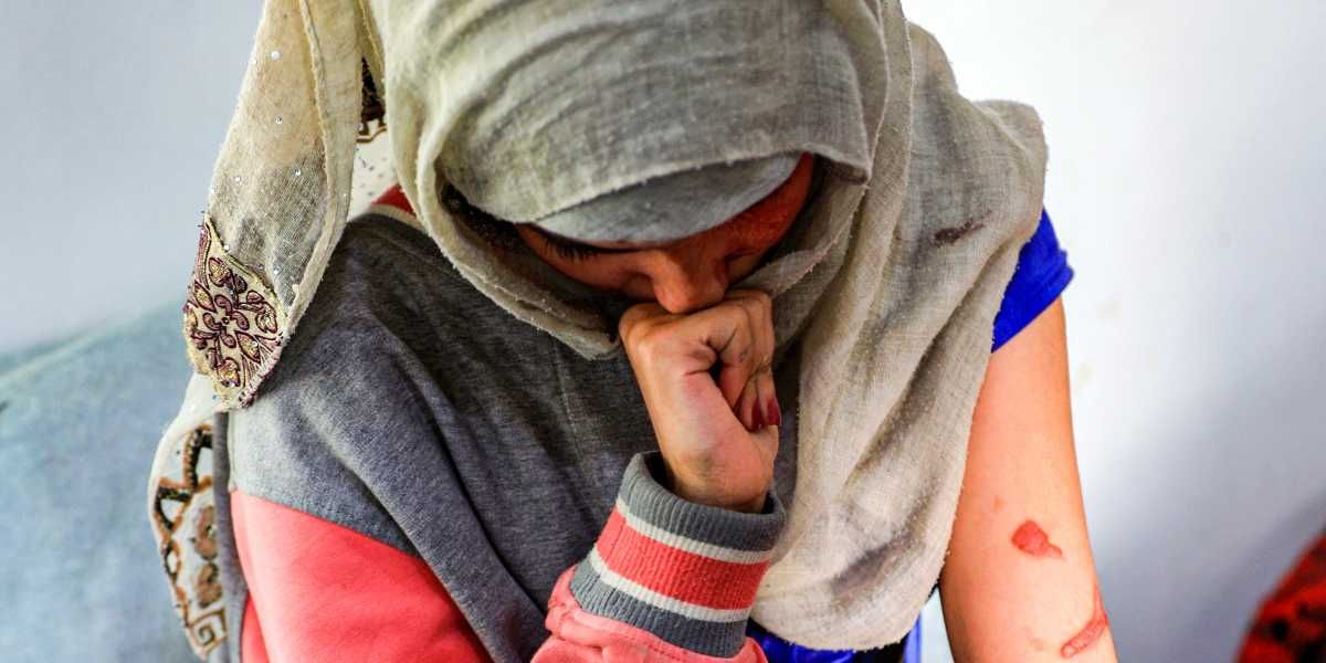 Al Anud Husein Sharian desfigurada ataque con acido yemen