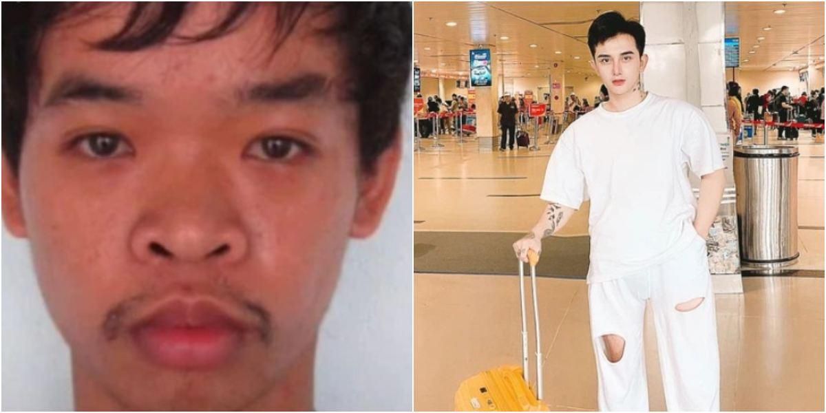 Joven vietnamita se operó nueve veces la cara para quedar bello