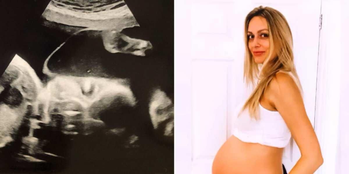 Rebecca Roberts mujer madre quedo embarazada cuando ya estaba embarazada reino unido