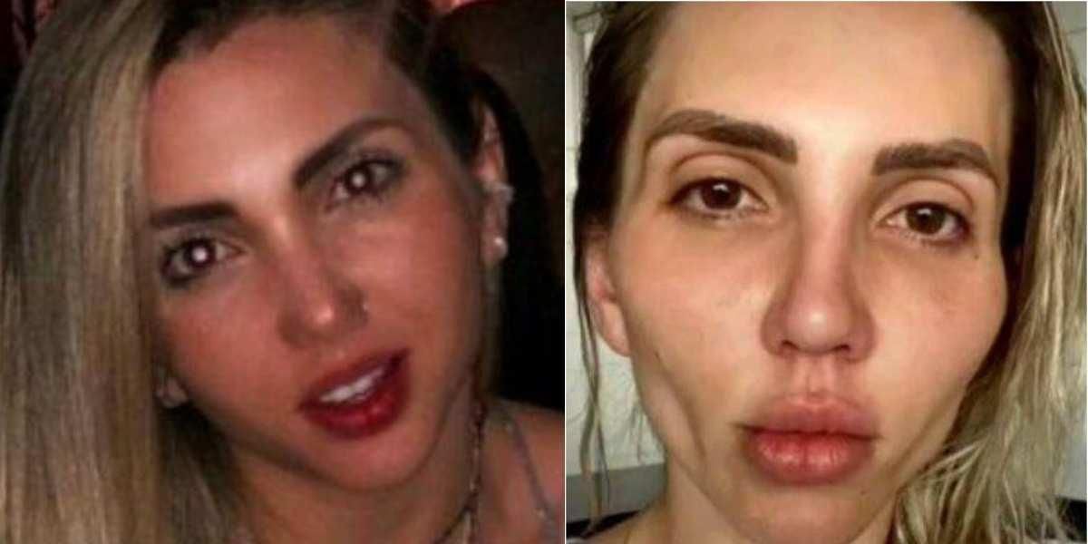 jessica frozza mujer joven advierte consecuencias bichectomia en su rostro