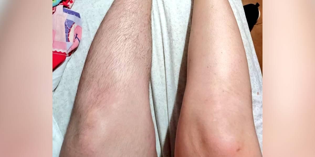mujer piernas depiladas depilacion