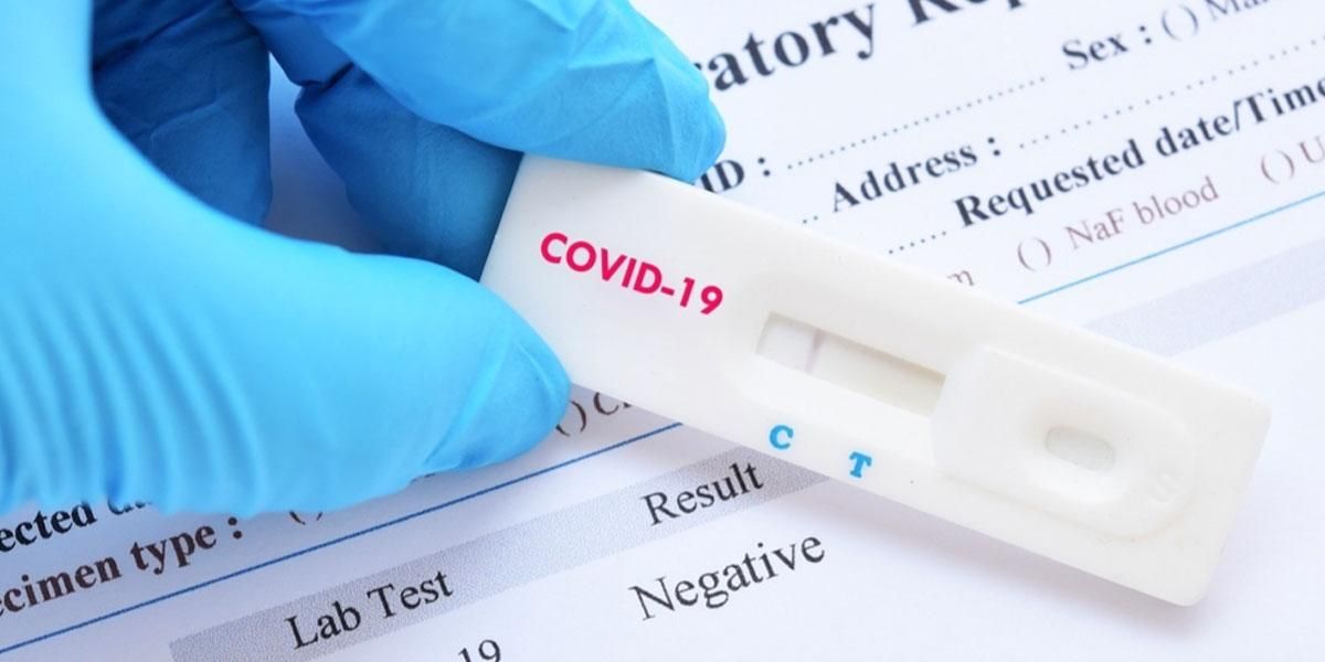 Gobierno prepara una norma contra la falsificación de pruebas COVID-19