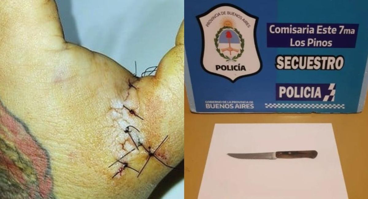 Padre atacó a un hombre que tatuó a su hija sin su consentimiento