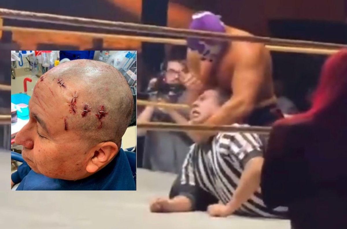 Video: Luchador apuñala y muerde la cabeza de un árbitro