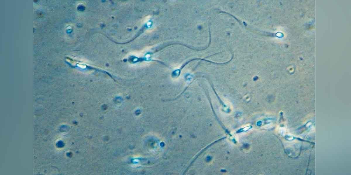 Científicos crean chip para separar los espermatozoides “buenos”