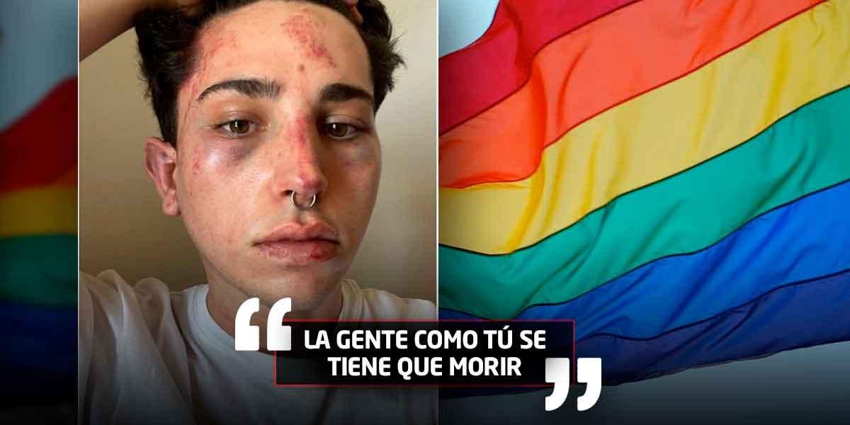 Joven denuncia brutal agresión en una discoteca por ser gay y que guardias “lo sacaron a la fuerza”