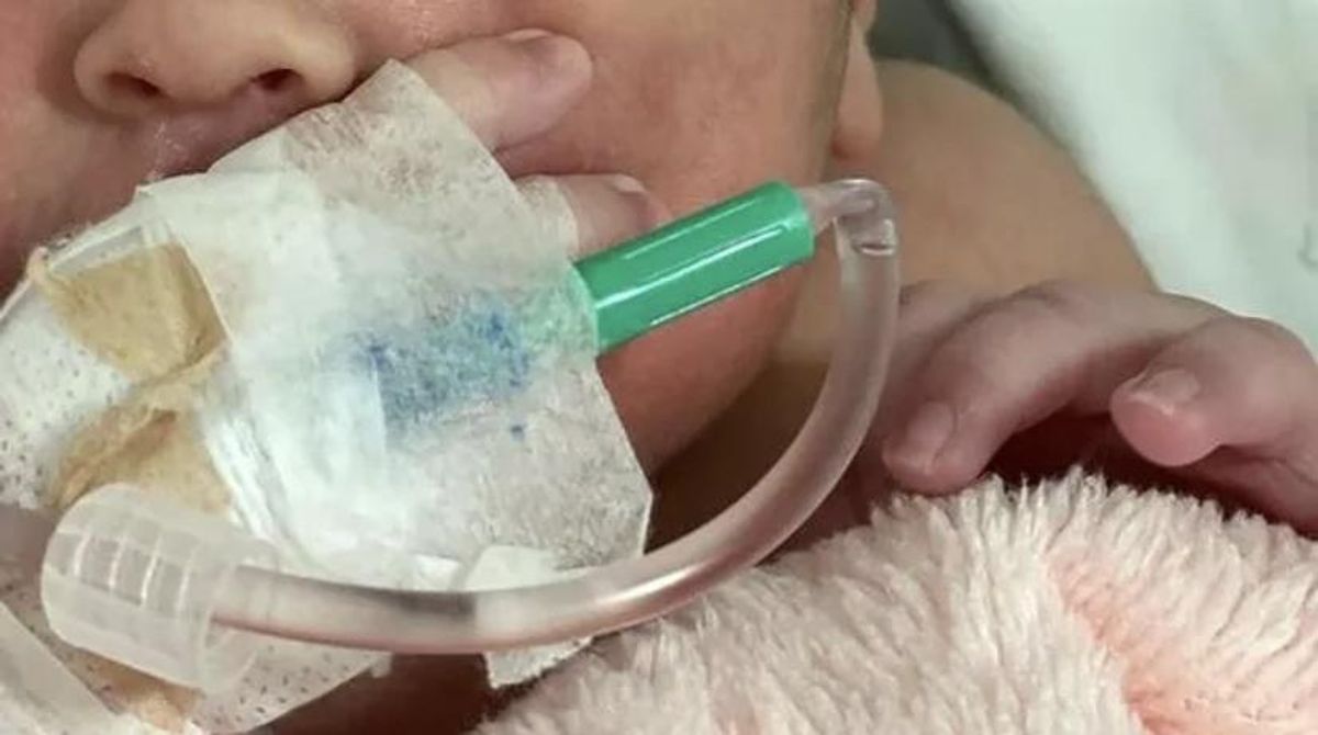 Bebé recién nacida cayó de cabeza tras el parto y recibió 11 puntos de sutura