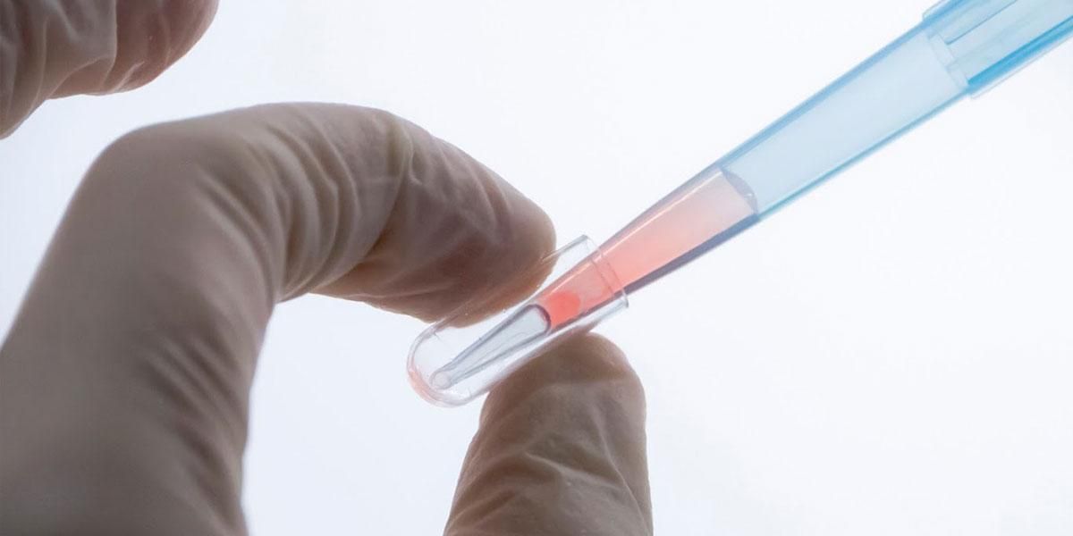Oncoliq: el test para detección del cáncer con una muestra de sangre