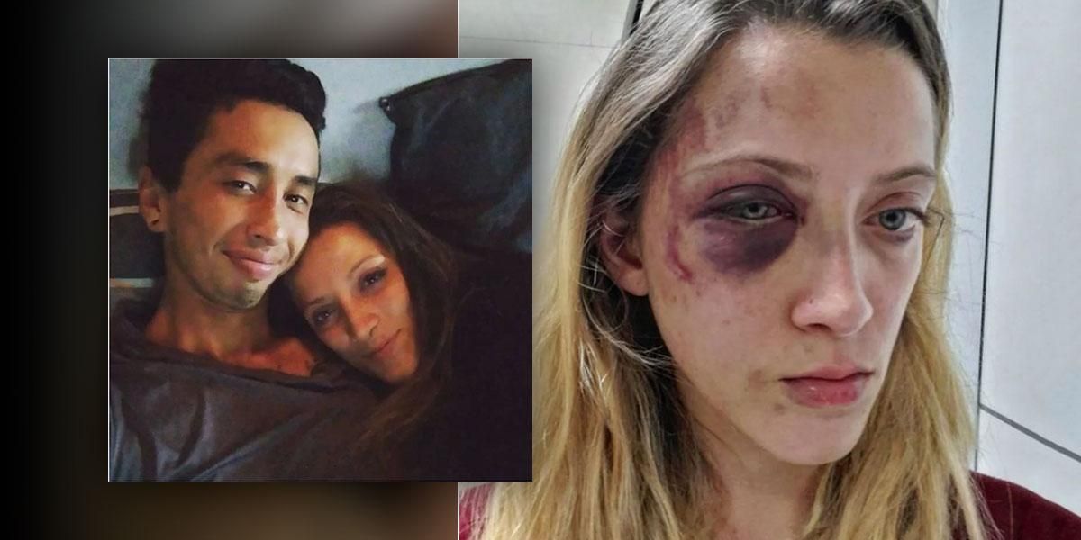 Por no querer tener relaciones sexuales, una joven bogotana fue brutalmente golpeada por su expareja