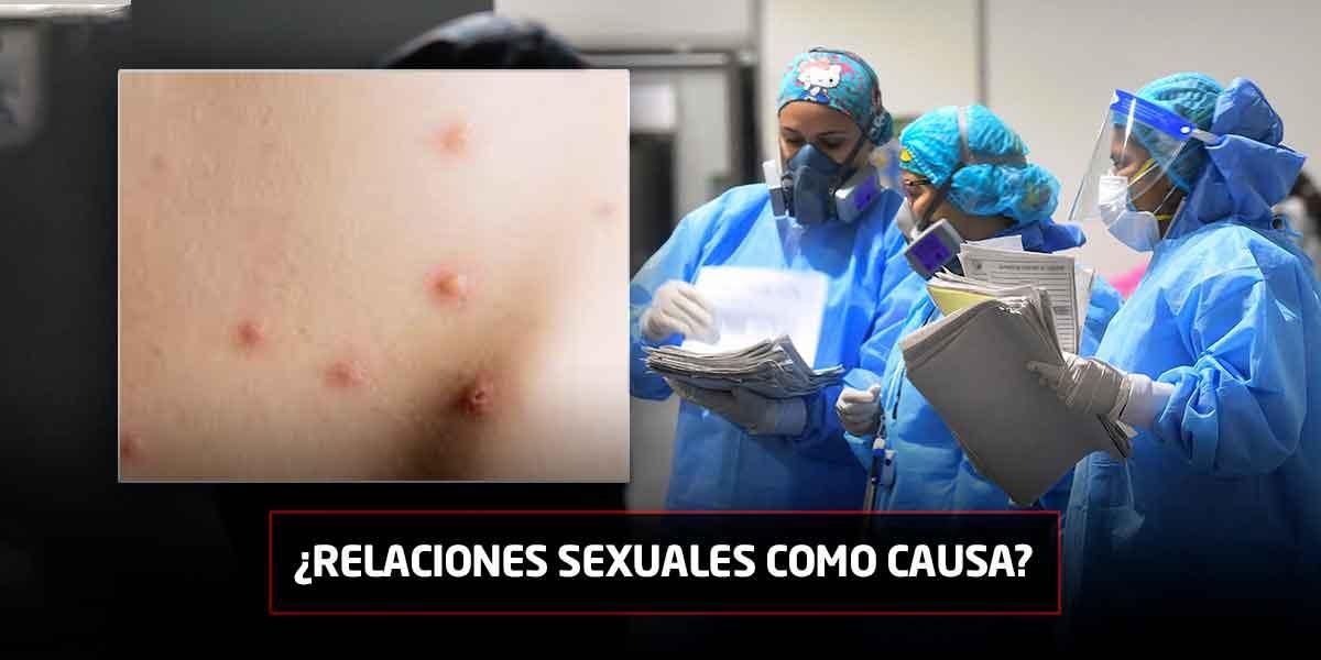 Perú-declara-la-alerta-sanitaria-tras-aumento-de-casos-de-viruela-del-mono
