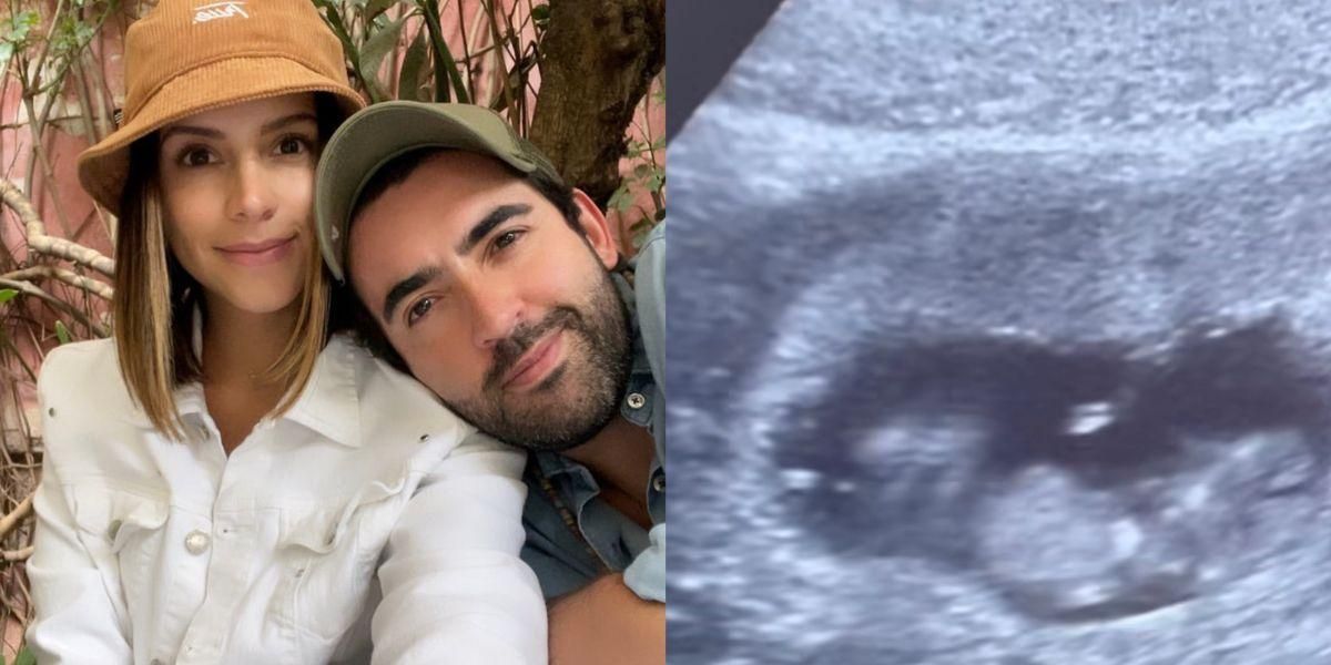 Este sería el sexo del bebé de Alejandro González y Manuela Cardona