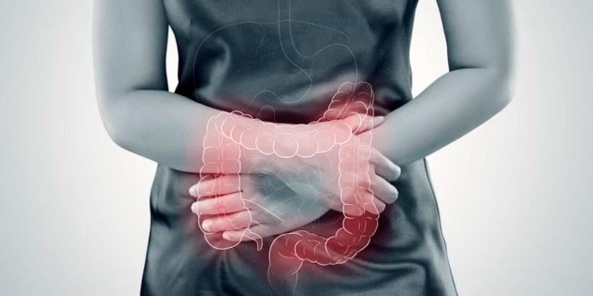 ¡Cuidado! El síndrome de colon irritable afecta más a las mujeres