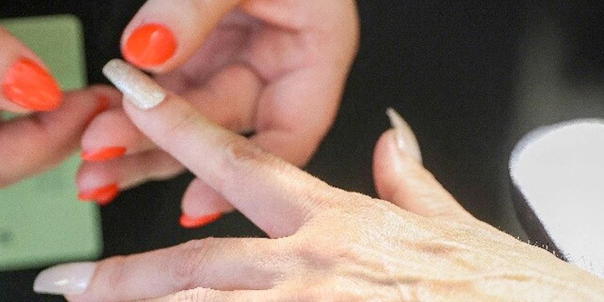 Una mujer contrajo cáncer tras arreglarse las uñas: “mi dedo parecía una ampolla”
