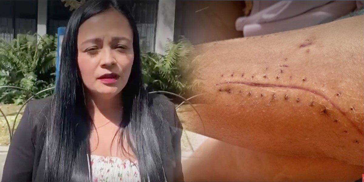 Mujer denuncia que también fue lanzada desde un TransMilenio por atracarla: ahora padece osteoporosis