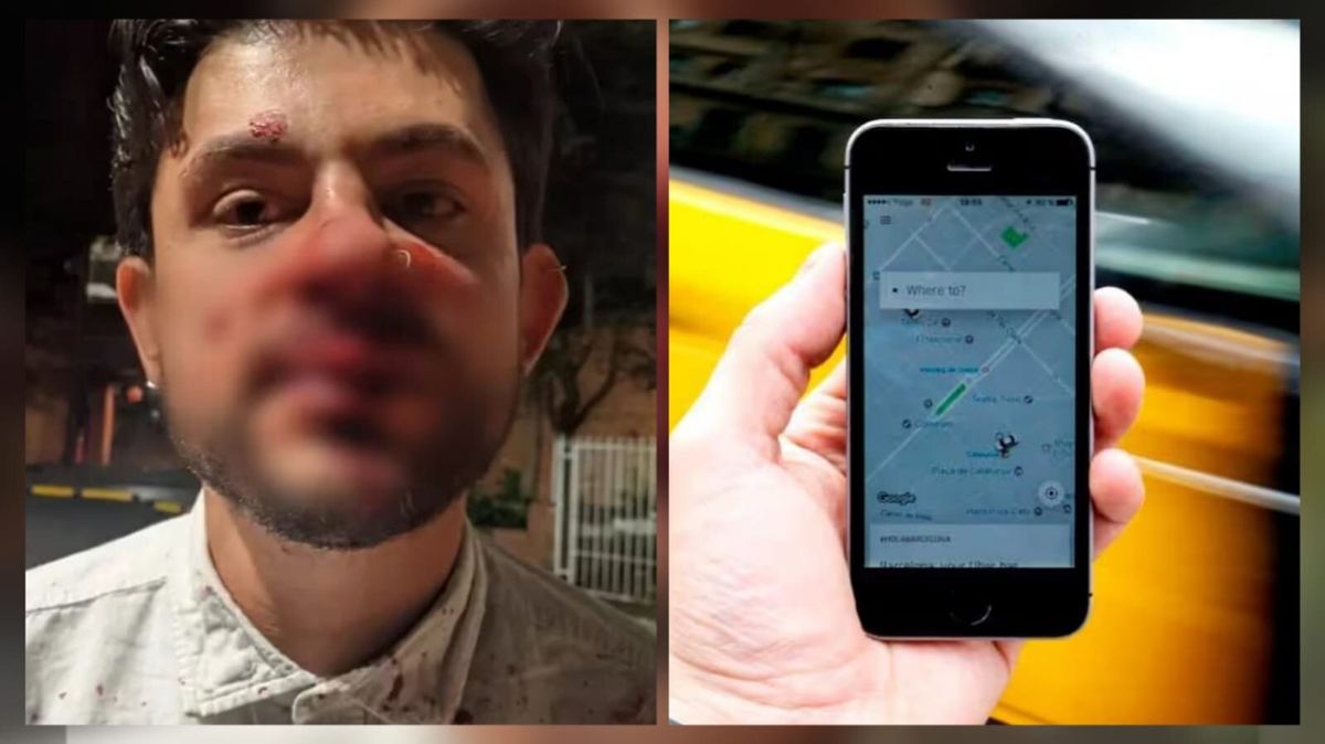 Joven denunció que conductor de Uber lo golpeó en la cara por comerse una empanada